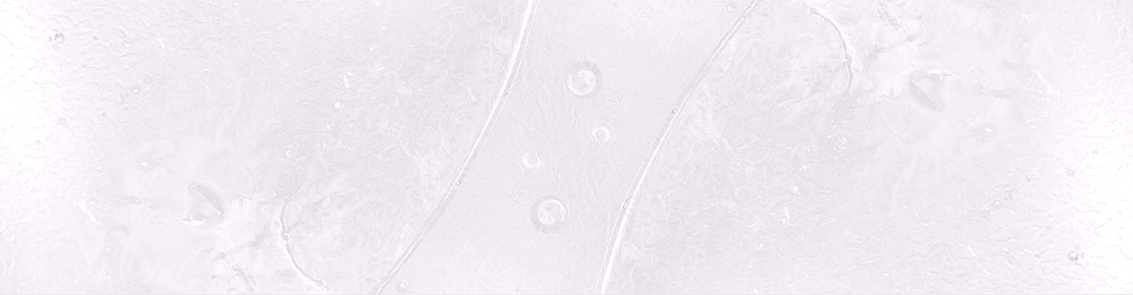 Abstract icy texture with subtle circular patterns.